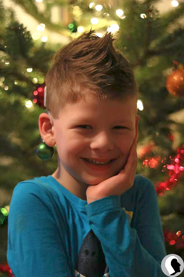 CI Kopf 2018 männlich Kind